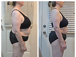 Before and After